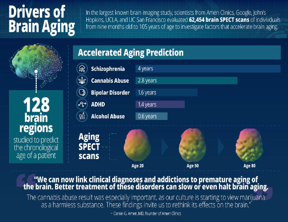 Drivers of brain aging. Image credit: Daniel G. Amen.