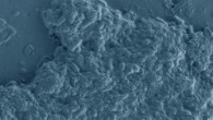 Scanning electron micrograph of Cutibacterium acnes. Magniﬁcation - 20,000x. Image credit: Yvonne Achermann et al, doi: 10.1128/CMR.00092-13.