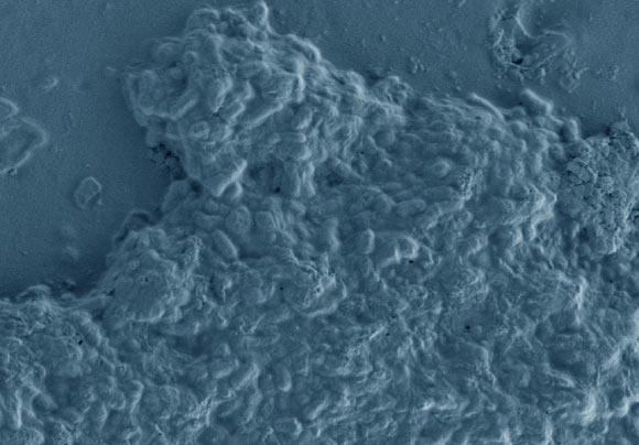 Scanning electron micrograph of Cutibacterium acnes. Magniﬁcation - 20,000x. Image credit: Yvonne Achermann et al, doi: 10.1128/CMR.00092-13.