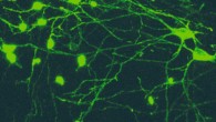 Microscopy image of OLM cells. Scale bar - 20 µm. Image credit: Mikulovic et al, doi: 10.1038/s41467-018-05907-w.