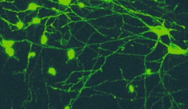 Microscopy image of OLM cells. Scale bar - 20 µm. Image credit: Mikulovic et al, doi: 10.1038/s41467-018-05907-w.