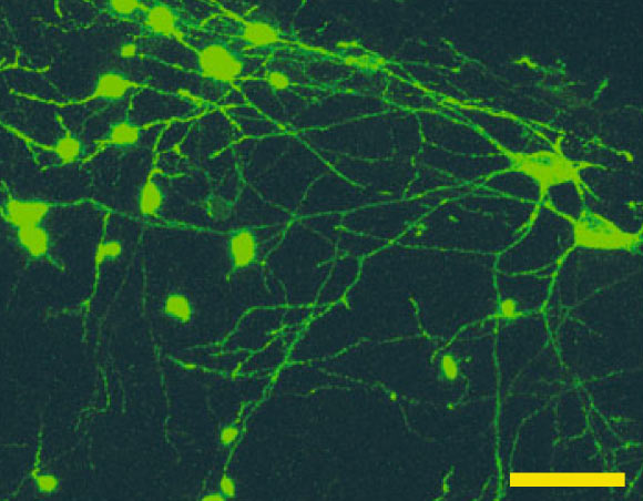 Microscopy image of OLM cells. Scale bar - 20 µm. Image credit: Mikulovic et al, doi: 10.1038/s41467-018-05907-w.