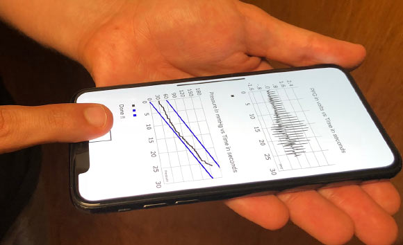 Chandrasekhar et al invented a proof-of-concept blood pressure app that can give accurate readings using an iPhone. Image credit: Michigan State University.