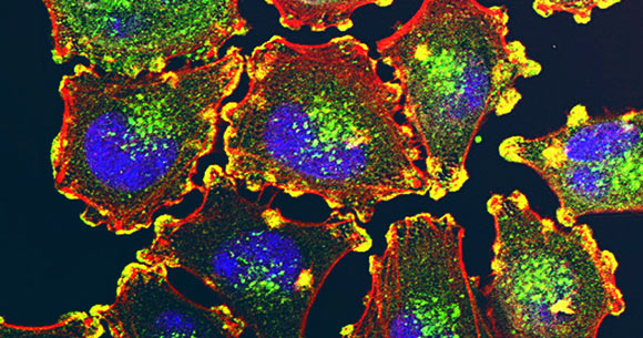 An experimental vaccine that boosts the immune system’s ability to fight cancers could work in tandem with other cancer therapies to fight aggressive tumors. Image credit: Julio C. Valencia, NCI Center for Cancer Research.