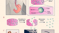 Karshalev et al created a micromotor pill and demonstrated its attractive use as a platform for oral delivery of active micromotors: (A) left: schematic of in vivo administration of a micromotor pill for actuation in the stomach; right: schematic of the micromotor pill composition consisting of a lactose/maltose pill matrix and the encapsulated a magnesium/titanium dioxide/polylactic-co-glycolic acid (Mg/TiO2/PLGA) micromotors; a zoom-in view illustrates the micromotor structure consisting of a Mg microsphere core with a TiO2 shell layer and a cargo-loaded PLGA film coating; (B) schematic of micromotor pill dissolution in gastric fluid and subsequent micromotor release; (C) left: image showing different sizes of disk-shaped micromotor pills; center: microscope image showing the dissolution of a micromotor pill in gastric fluid simulant; right: propulsion of the released Mg-based micromotors in gastric fluid simulant. Image credit: Karshalev et al, doi: 10.1021/acsnano.8b03760.