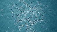 This image shows a single human skeletal stem cell-derived colony. Image credit: Chan et al, doi: 10.1016/j.cell.2018.07.029.