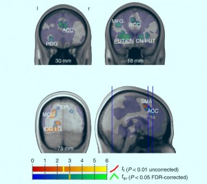 Neuroscientists Identify Brain Areas Responsible for Choice Overload ...