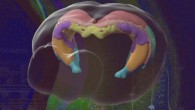Brain mapping helps neuroscientists understand how specific areas function and how to create new drugs and targeted treatments. Image credit: Jim Stanis and Tyler Ard, USC Mark and Mary Stevens Neuroimaging and Informatics Institute.