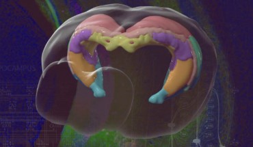 Brain mapping helps neuroscientists understand how specific areas function and how to create new drugs and targeted treatments. Image credit: Jim Stanis and Tyler Ard, USC Mark and Mary Stevens Neuroimaging and Informatics Institute.