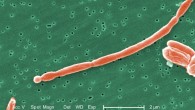 Under a high magnification of 12,960x, this SEM image revealed some of the morphologic details displayed by a number of joined, Gram-negative, rod-shaped, Escherichia coli bacteria. Image credit: Janice Haney Carr, CDC.