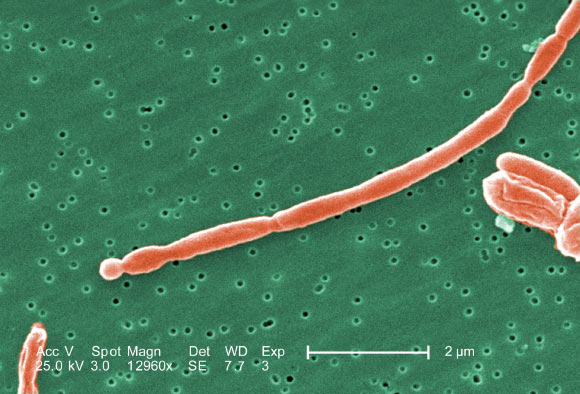Under a high magnification of 12,960x, this SEM image revealed some of the morphologic details displayed by a number of joined, Gram-negative, rod-shaped, Escherichia coli bacteria. Image credit: Janice Haney Carr, CDC.