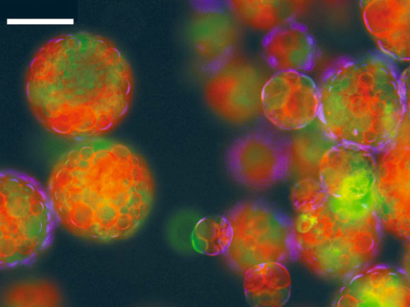 Fluorescence optical microscopy image showing emulsion droplets consisting of caged multi-compartmentalized spheroids containing a closely packed mixture of proteinosomes dispersed in oil. Scale bar - 100 μm. Image credit: Gobbo et al, doi: 10.1038/s41563-018-0183-5.