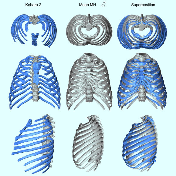 Comparison of the Kebara 2 thorax (left column) to the modern human male sample (in gray; middle column) and superposition of the two morphologies (in blue, Kebara 2; in gray, the modern human sample male mean; right column) in cranial (top row), ventral (middle row) and left lateral (lower row) views. Image credit: Gómez-Olivencia et al, doi: 10.1038/s41467-018-06803-z.