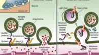Mechanism of action of botulinum toxin: the light chain of (BT-A) cleaves SNAP-25 (synaptosome-associated protein of 25 KDa) and consequently prevents the release of acetylcholine into the neuromuscular junction. Image credit: Ali S. Al-Ghamdi et al, doi: 10.1016/j.jdds.2014.06.002.