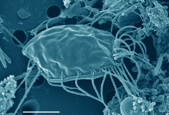 Hemimastix kukwesjijk: general view of cell. Scale bar - 5 μm. Image credit: Lax et al, doi: 10.1038/s41586-018-0708-8.