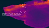 The endorestiform nucleus is found near the brain-spinal cord junction. Image credit: George Paxinos, Neuroscience Research Australia.