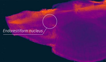 The endorestiform nucleus is found near the brain-spinal cord junction. Image credit: George Paxinos, Neuroscience Research Australia.