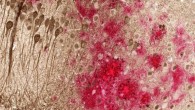 Toxic amyloid plaques (red) and tau tangles (brown) form on the brain of a mouse modeled to have Alzheimer’s disease. Image credit: University of Texas Southwestern.