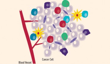 The cellular compartment of the tumor microenvironment is made up of tumor cells, immune cells, and stromal cells. Image credit: National Cancer Institute.