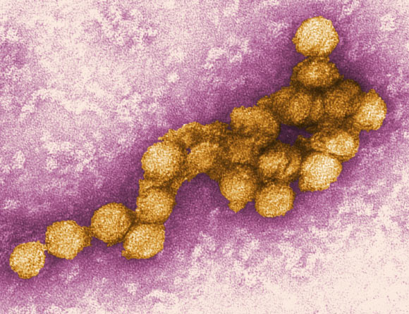This is a digitally-colorized transmission electron microscopic (TEM) image of the West Nile virus. Image credit: Cynthia Goldsmith / P.E. Rollin / CDC.