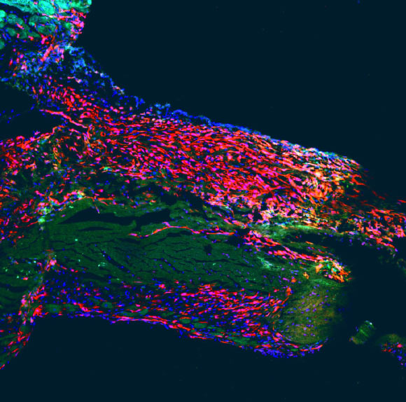 Part of the heart wall of the murine heart after myocardial infarction; visible are the scar tissue (red) and dead heart muscle cells (pale green). Image credit: Hubrecht Institute.