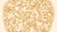 Microscopy image of Sulfolobus solfataricus. Image credit: D. Janckovik / W. Zillig.