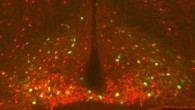 He et al found that a single workout can activate POMC neurons (shown in green in yellow) for up to 2 days; these neurons are important regulators of blood glucose levels and energy balance. Image credit: He et al, doi: 10.1016/j.molmet.2018.08.011.