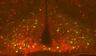 He et al found that a single workout can activate POMC neurons (shown in green in yellow) for up to 2 days; these neurons are important regulators of blood glucose levels and energy balance. Image credit: He et al, doi: 10.1016/j.molmet.2018.08.011.
