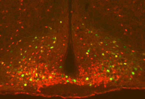 He et al found that a single workout can activate POMC neurons (shown in green in yellow) for up to 2 days; these neurons are important regulators of blood glucose levels and energy balance. Image credit: He et al, doi: 10.1016/j.molmet.2018.08.011.