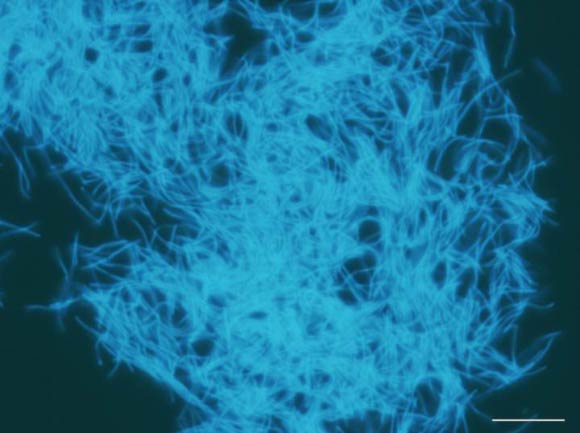 This image shows a species of methanogenic bacteria; found in samples from a buried coal bed 1.2 miles (2 km) below the Pacific Ocean floor off the coast of Japan, this specimen was retrieved during an Integrated Ocean Drilling Program (now the International Ocean Discovery Program) expedition aboard the Drilling Vessel Chikyu. Scale bar - 10 μm. Image credit: Hiroyuki Imachi, Japan Agency for Marine-Earth Science and Technology.