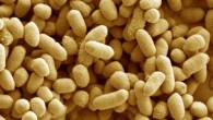 Bacteroides thetaiotaomicron. Image credit: Kathryn Cross & Nikki Horn, Institute of Food Research.