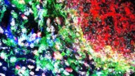 Wild-type mice were challenged with Candida albicans and immunofluorescence staining for DAPI, IBA1, Aβ, and GFAP was performed on brain sections containing fungal granulomas. Image credit: Wu et al, doi: 10.1038/s41467-018-07991-4.
