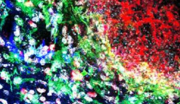 Wild-type mice were challenged with Candida albicans and immunofluorescence staining for DAPI, IBA1, Aβ, and GFAP was performed on brain sections containing fungal granulomas. Image credit: Wu et al, doi: 10.1038/s41467-018-07991-4.