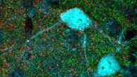 Ribic et al discovered a new molecular mechanism that is essential for brain maturation and may be used to restore plasticity in aged brains. Image credit: Adema Ribic / Tufts University School of Medicine.