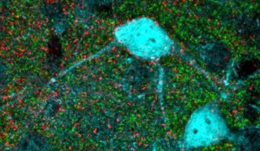 Ribic et al discovered a new molecular mechanism that is essential for brain maturation and may be used to restore plasticity in aged brains. Image credit: Adema Ribic / Tufts University School of Medicine.