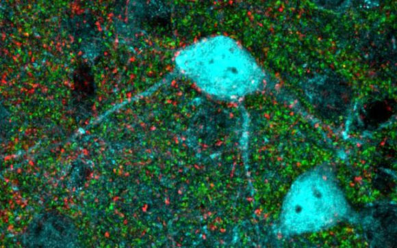 Ribic et al discovered a new molecular mechanism that is essential for brain maturation and may be used to restore plasticity in aged brains. Image credit: Adema Ribic / Tufts University School of Medicine.