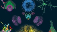 ExLLSM (expansion/lattice light-sheet microscopy) images neural structures with molecular contrast over millimeter-scale volumes, including (clockwise from top right) mouse pyramidal neurons and their processes; organelle morphologies in somata; dendritic spines and synaptic proteins across the cortex; stereotypy of projection neuron boutons in Drosophila; projection neurons traced to the central complex; and (center) dopaminergic neurons across the brain, including the ellipsoid body (circular inset). Image credit: Gao et al, doi: 10.1126/science.aau8302.