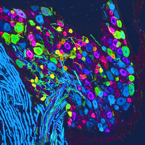 The unpleasantness of pain is an emotional phenomenon distinct from pain’s sensory qualities. To study how the brain processes pain-related emotions, Corder et al used neural calcium imaging in freely behaving mice. The team identified brain circuits that respond to pain and directly tested their causal role in motivational behaviors associated with acute and chronic pain. Image credit: Corder et al, doi: 10.1126/science.aap8586.