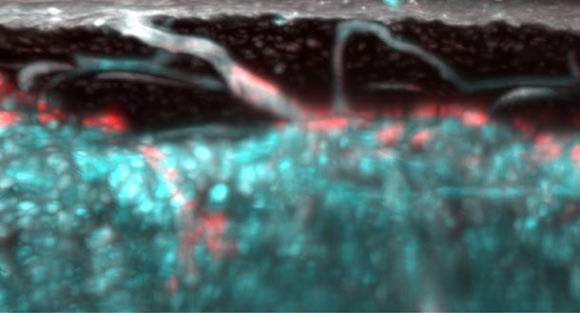 Closed circulatory systems underlie the function of vertebrate organs, but in long bones their structure is unclear although they constitute the exit route for bone marrow leukocytes. To understand neutrophil migration from bone marrow, Grüneboom et al studied the vascular system of murine long bones. In a mouse model, the team shows that hundreds of capillaries originate in bone marrow, traverse cortical bone perpendicularly along the shaft and connect to the periosteal circulation. Structures similar to these trans-cortical vessels also exist in human limb bones. Image credit: Grüneboom et al, doi: 10.1038/s42255-018-0016-5.