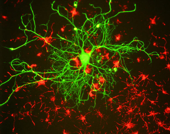 Cortical neuron stained with antibody to neurofilament subunit NF-L in green. Image credit: Gerry Shaw / CC BY-SA 3.0.