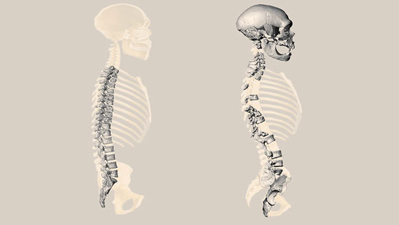 Previous (left) and new reconstructions of the Neanderthal spine. Image credit: Haeusler et al / Been et al.