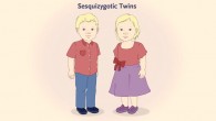 Sesquizygosis -- whereby twins are genetically identical to each other with respect to one parent but differ from each other by approximately 50% with respect to the composition of DNA inherited from the other parent -- is a third form of twinning. Genetically, sesquizygosis can be considered to be on a continuum between monozygosis and dizygosis. It probably arises after heterogoneic assortment of two paternal genomes and one maternal genome during the first postzygotic cleavage division. Image credit: Gabbett et al, doi: 10.1056/NEJMoa1701313.