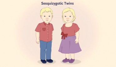 Sesquizygosis -- whereby twins are genetically identical to each other with respect to one parent but differ from each other by approximately 50% with respect to the composition of DNA inherited from the other parent -- is a third form of twinning. Genetically, sesquizygosis can be considered to be on a continuum between monozygosis and dizygosis. It probably arises after heterogoneic assortment of two paternal genomes and one maternal genome during the first postzygotic cleavage division. Image credit: Gabbett et al, doi: 10.1056/NEJMoa1701313.
