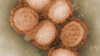 tBHQ, at a dose relevant to human diet, impairs the primary and memory immune responses to influenza infection. Image credit: C. S. Goldsmith & A. Balish / CDC.
