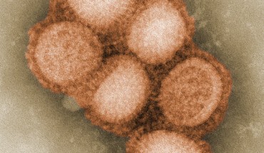 tBHQ, at a dose relevant to human diet, impairs the primary and memory immune responses to influenza infection. Image credit: C. S. Goldsmith & A. Balish / CDC.