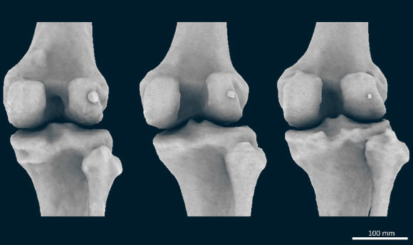 Large (left), medium (center), and small (right) fabellae (a small bone to the right of each image) in the right knees of three female subjects. Image credit: Berthaume et al, doi: 10.1111/joa.12994.