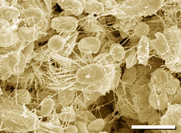 This colorized image shows a species of the haloarchaea genus Halorubrum. Scale bar - 2 μm. Image credit: Reid et al, doi: 10.1017/S1473550406002916.