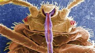 This digitally-colorized scanning electron micrograph revealed some of the ultrastructural morphology displayed on the ventral surface of Cimex lectularius; from this view you can see the insect’s skin piercing mouthparts it uses to obtain its blood meal, as well as a number of its six jointed legs. Image credit: Janice Harney Carr, CDC.