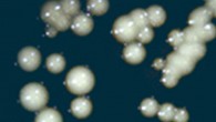 The beer-producing yeast strain EBEgT12 isolated from a vessel from the site of En-Besor, Israel. Image credit: Aouizerat et al, doi: 10.1128/mBio.00388-19.