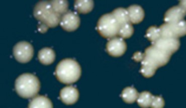 The beer-producing yeast strain EBEgT12 isolated from a vessel from the site of En-Besor, Israel. Image credit: Aouizerat et al, doi: 10.1128/mBio.00388-19.